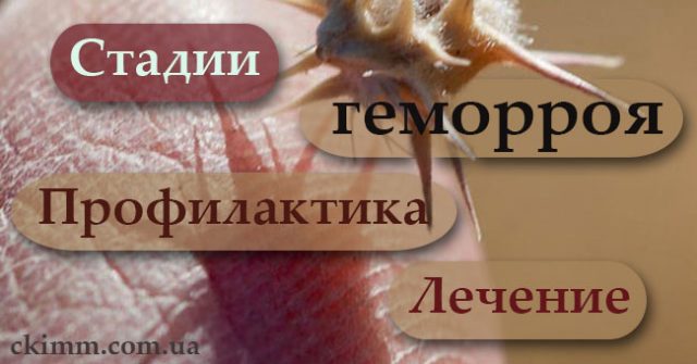 Стадии геморроя, профилактика, лечение, последствия Стадии геморроя подробно описаны в статье